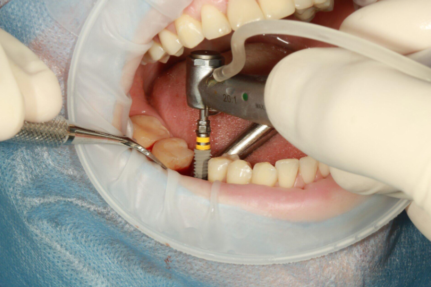 How to choose Right Dental